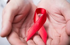 HIV/AIDS model launched in Hanoi
