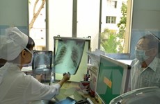 Vietnam aims to reduce number of tuberculosis patients 