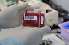 National hematology institute expands stem cell collection services