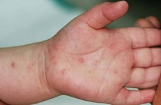 Large amount of hand-foot-mouth disease treatment drug provided to hospitals