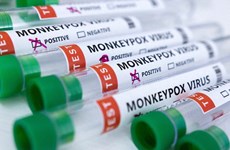 Cambodia logs three more monkeypox cases