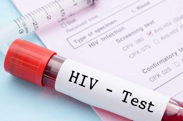 New strategy needed to improve HIV treatment quality hinh anh 1
