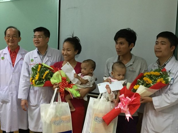 Conjoined twins separated at HCM City’s hospital hinh anh 1