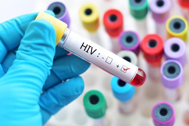 Hanoi has country’s second highest rate of HIV/AIDS hinh anh 1