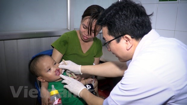 Children with facial deformities to receive free check-ups, surgerical operations hinh anh 1