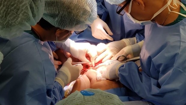 HCM City's doctors separate conjoined twins hinh anh 1