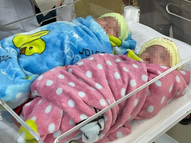 Twins survive after premature birth, weighing just 500g hinh anh 1